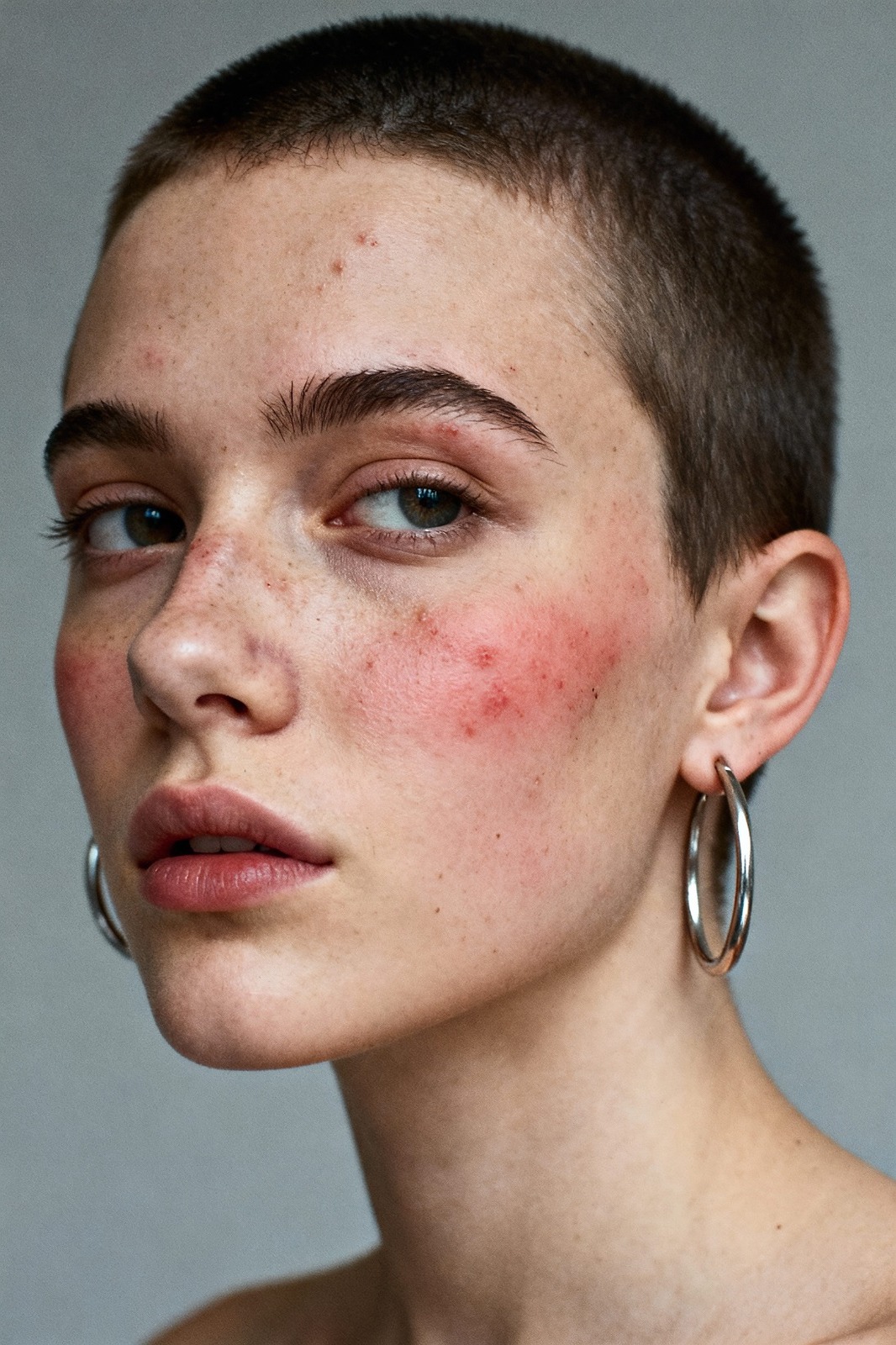 Hair Fall & Strengthening 