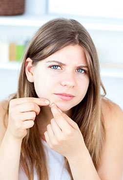 Acne & Blemish Control