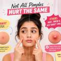 Why Some Pimples Hurt More Than Others: Understanding Different Acne Types